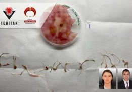 Moleküler Biyoloji ve Genetik Bölümü Öğrencilerimizden Gökçe Naz AKIN’ın Projesi "TÜBİTAK 2209-A Destekleme Programı" Kapsamında Destek Almaya Hak Kazandı