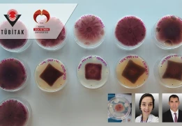 Moleküler Biyoloji ve Genetik Bölümü Öğrencilerimizden Mine Berrak HALİK’in Projesi "TÜBİTAK 2209-A Destekleme Programı" Kapsamında Destek Almaya Hak Kazandı